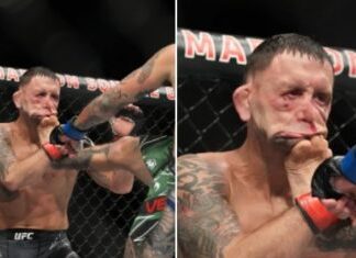 UFC: Frankie Edgar fica irreconhecível depois levar chute no rosto
