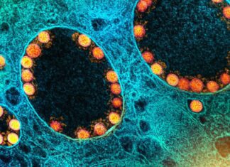 França identifica nova variante do coronavírus com mais de 40 mutações