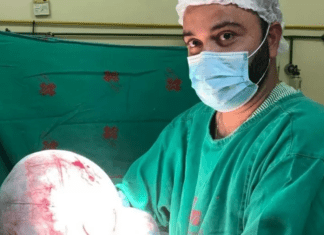 Médico registra extração de ‘cisto gigante’ de pelo menos 8 kg