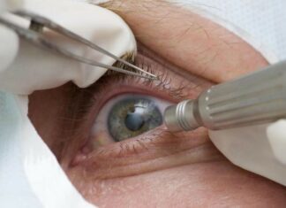 Abril Marrom alerta sobre doenças que podem levar à cegueira