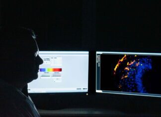 Estudo busca identificar tratamento gênico para Síndrome de Pitt-Hopki