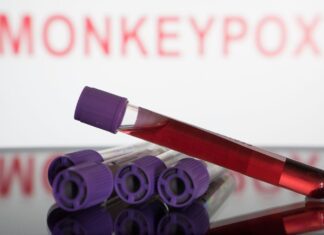 Brasil faz 8.850 testes de varíola dos macacos