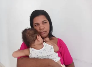 Bebê de 1 ano é diagnosticada com assimetria craniana; mãe faz campanha para realizar tratamento