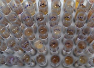 Casos de malária no Brasil caem 26% no primeiro trimestre de 2025