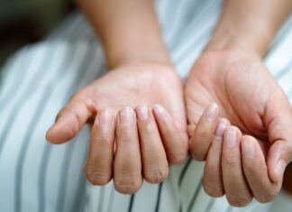 Unhas fracas, quebradiças ou espessas podem indicar problemas de saúde Unhas fracas, quebradiças ou espessas podem indicar problemas de saúde