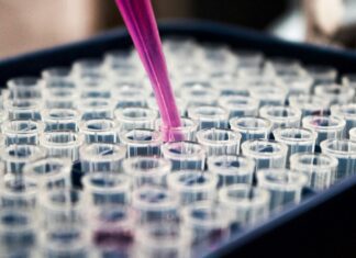 Estudo mostra que inflamação no cérebro pode ser chave do Alzheimer