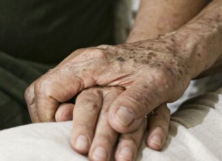 Demência por corpos de Lewy: entenda doença de Milton Nascimento