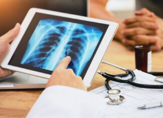 SRAG: quais vírus podem levar ao quadro que causou emergência?