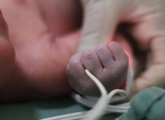 SUS Passa A Oferecer Cirurgia Para Lábio Leporino E Fenda Palatina