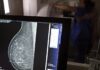 Entidades alertam médicos sobre pedidos de mamografia digital