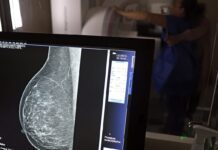 Entidades alertam médicos sobre pedidos de mamografia digital
