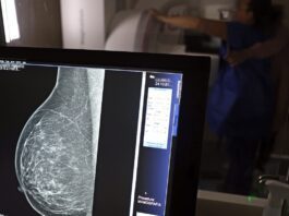 Entidades alertam médicos sobre pedidos de mamografia digital