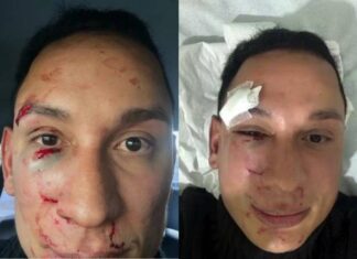 Dentista é Espancado Em Camarote Durante São João De Irecê