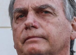 Pneumonia Viral: Bolsonaro Passa Por Exames E Começa Tratamento
