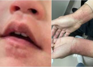 Médica Ataca Criança De 2 Anos Com Spray De Pimenta Durante Missa Em Jundiaí