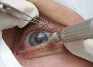 Lula faz cirurgia de catarata; entenda a doença e o procedimento