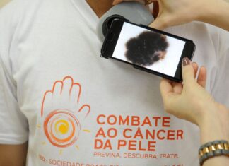 Qual o FPS certo do protetor? Saiba como proteger a pele do sol