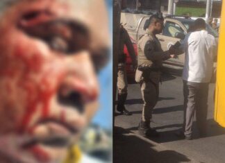 Rodoviário é Agredido Com Marteladas Em Salvador; Veja Onde