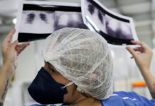 Diagnóstico tardio dá poucas chances de cura do câncer de pulmão