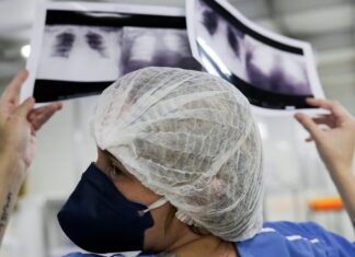 Brasil deve ter 781 mil novos casos de câncer por ano até 2028