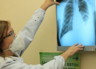 Tuberculose: em 2024 foram 85 mil casos e 6 mil mortes em todo país