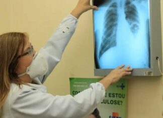 Lei Cria Campanha Para Conscientização Sobre Câncer De Pulmão