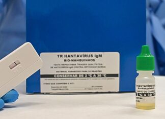 Novo teste faz diagnóstico de hantavirose em 20 minutos