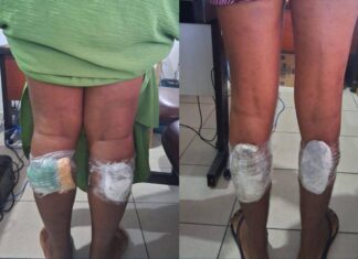 Mulheres São Presas Ao Tentar Entrar Com Drogas Em Presídio De Salvador