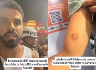 Denúncia De Agressão Homofóbica No Carnaval Leva Ao Afastamento De PMs