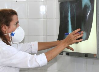 OMS recomenda testes de diagnóstico rápido para erradicar tuberculose