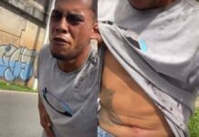 Influenciador é Baleado Na Rótula Do Abacaxi E Grava Pedido De Socorro