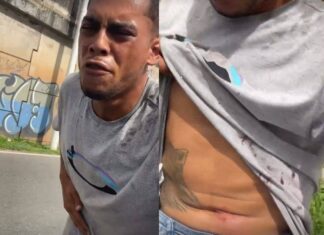 Influenciador é Baleado Na Rótula Do Abacaxi E Grava Pedido De Socorro