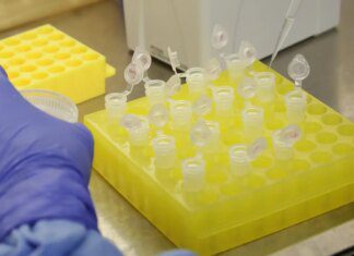 SP confirma segundo caso importado de sarampo