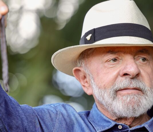 Lula vai a SP para tirar excesso de pele na cabeça e tratar tendinite