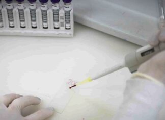 Paciente em SP com suspeita de ebola testa positivo para meningite