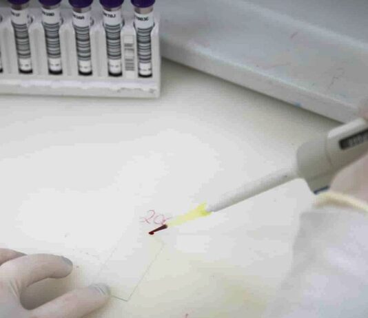 Paciente em SP com suspeita de ebola testa positivo para meningite