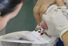 Setembro Roxo alerta para a fibrose cística, a doença do beijo salgado