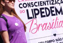 Lipedema: doença crônica vai além da questão estética