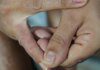Dermatite atópica impacta pele, sono e autoestima: saiba como tratar