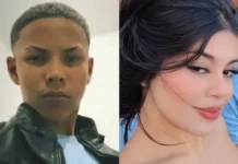 Jovem Sofre Queimaduras Em 30% Do Corpo Após Ataque Do Ex